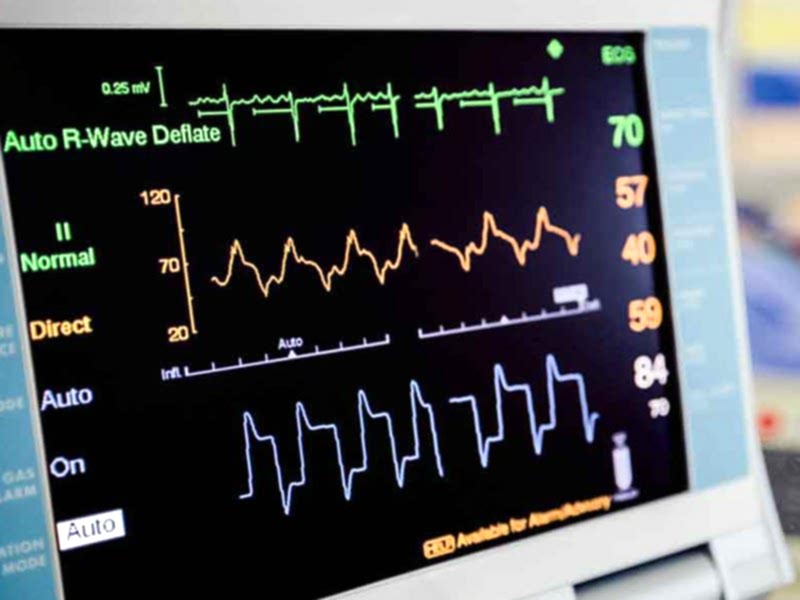 EKG